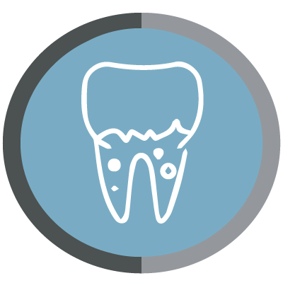 Periodoncia y tratamiento de encías en Chiclana